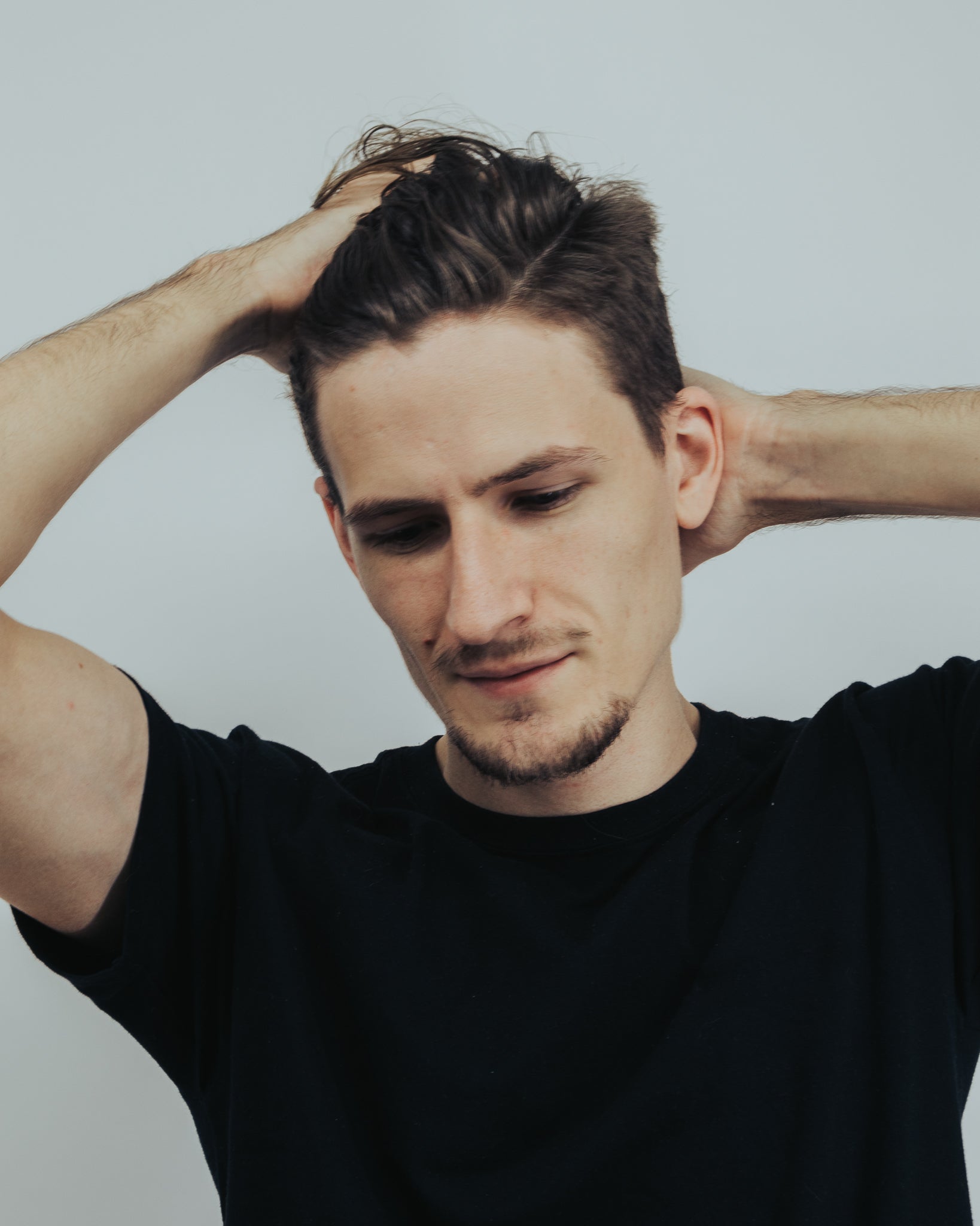 Types of Hair Loss