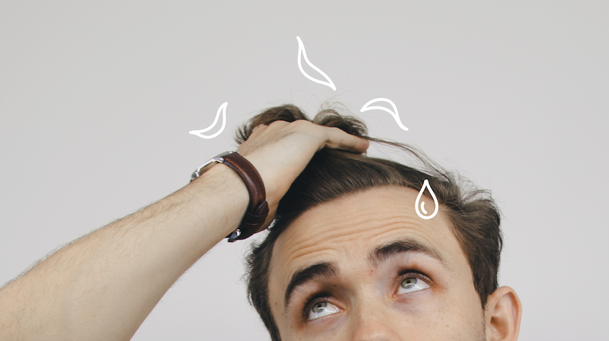 Male Pattern Balding