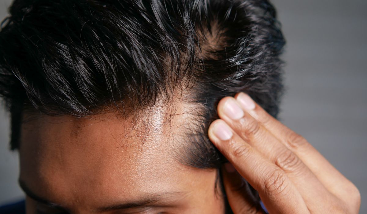Effective Hair Loss Treatment in South Africa